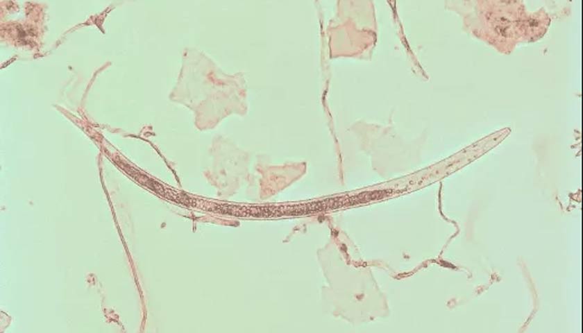 What Are Nematodes?