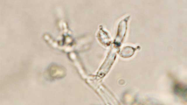 Criteria for Successful Biocontrol Candidates on the Farm