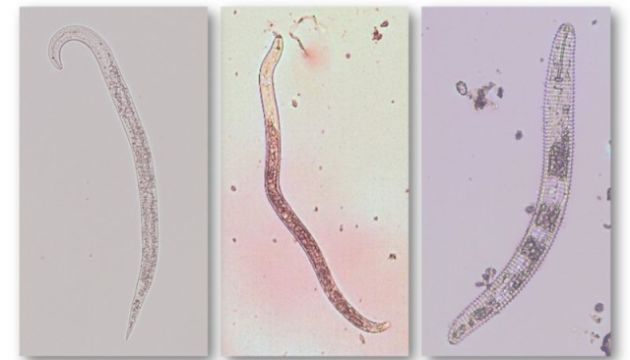 Nematodes Cost California Growers Millions